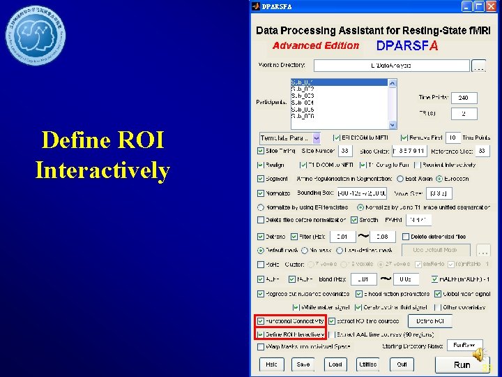 Define ROI Interactively 33 