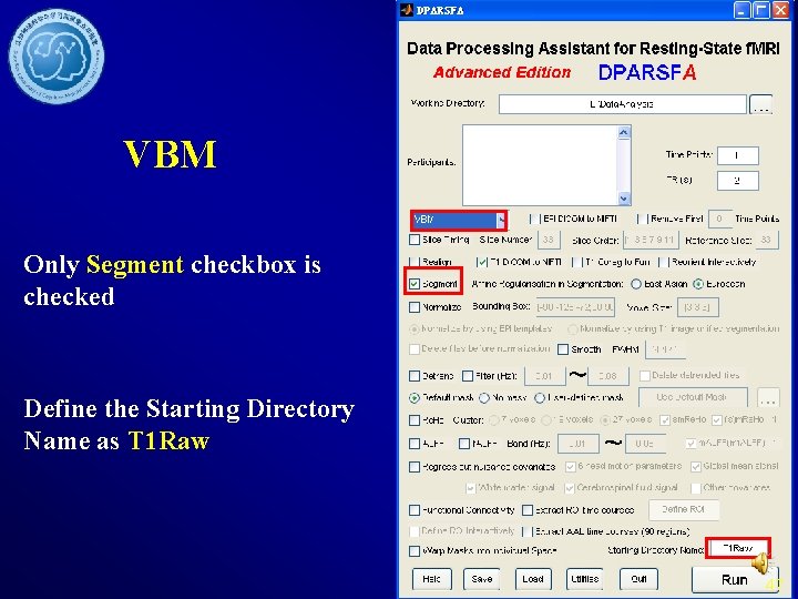 VBM Only Segment checkbox is checked Define the Starting Directory Name as T 1