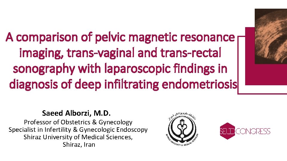 A comparison of pelvic magnetic resonance imaging, trans-vaginal and trans-rectal sonography with laparoscopic findings