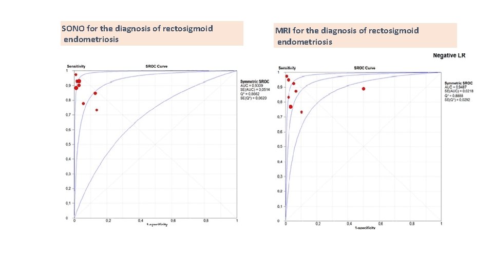 SONO for the diagnosis of rectosigmoid endometriosis MRI for the diagnosis of rectosigmoid endometriosis