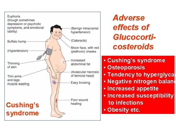 Adverse effects of Glucocorticosteroids Cushing’s syndrome • Cushing’s syndrome • Osteoporosis • Tendency to