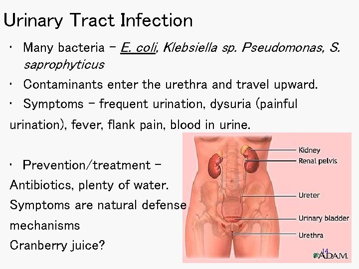 Urinary Tract Infection • Many bacteria – E. coli, Klebsiella sp. Pseudomonas, S. saprophyticus