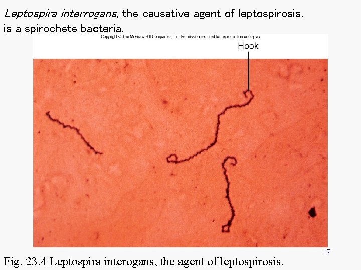 Leptospira interrogans, the causative agent of leptospirosis, is a spirochete bacteria. Fig. 23. 4