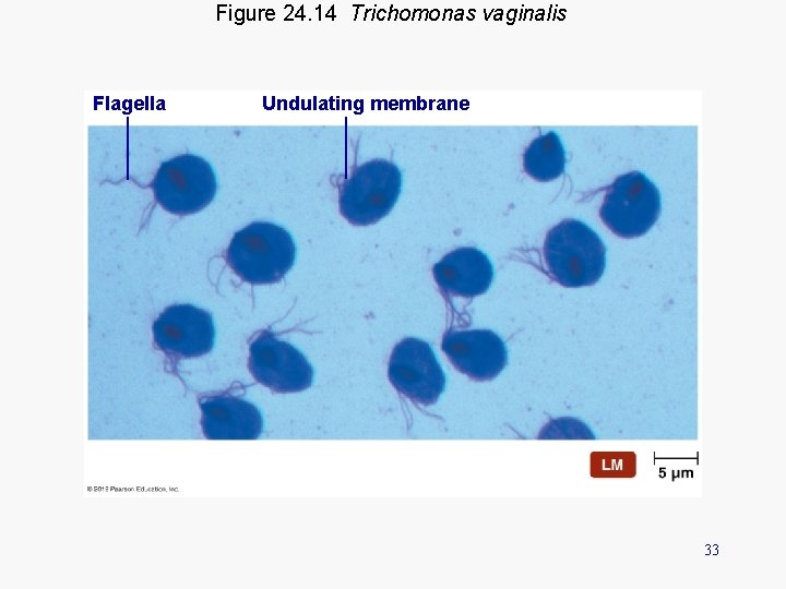 Figure 24. 14 Trichomonas vaginalis Flagella Undulating membrane 33 