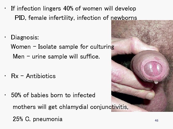  • If infection lingers 40% of women will develop PID, female infertility, infection