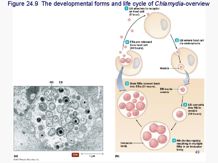 Figure 24. 9 The developmental forms and life cycle of Chlamydia-overview 49 