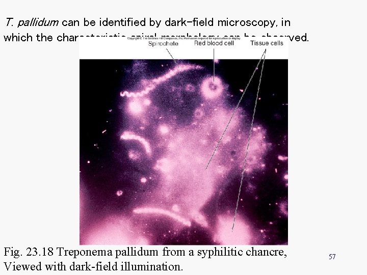 T. pallidum can be identified by dark-field microscopy, in which the characteristic spiral morphology