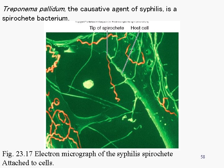 Treponema pallidum, the causative agent of syphilis, is a spirochete bacterium. Fig. 23. 17