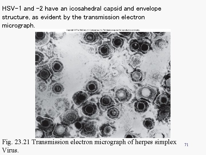 HSV-1 and – 2 have an icosahedral capsid and envelope structure, as evident by