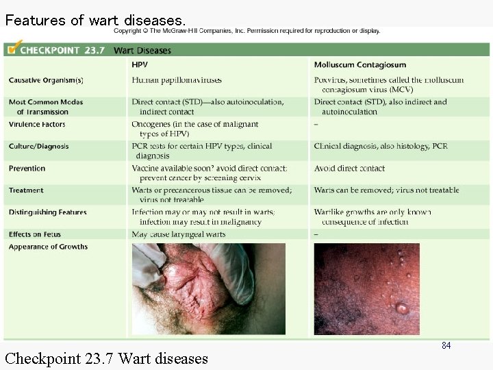 Features of wart diseases. Checkpoint 23. 7 Wart diseases 84 