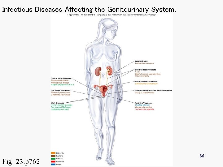 Infectious Diseases Affecting the Genitourinary System. Fig. 23. p 762 86 