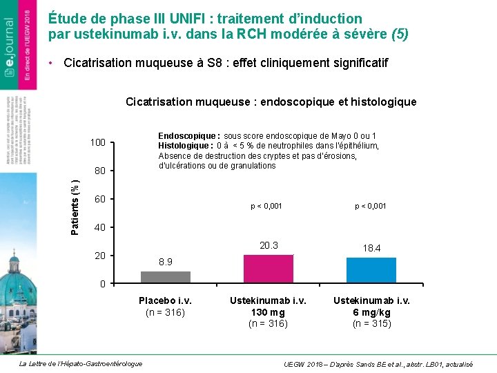 Étude de phase III UNIFI : traitement d’induction par ustekinumab i. v. dans la