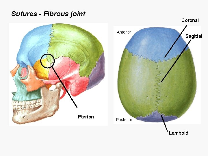 Sutures - Fibrous joint Coronal Anterior Pterion Sagittal Posterior Lamboid 