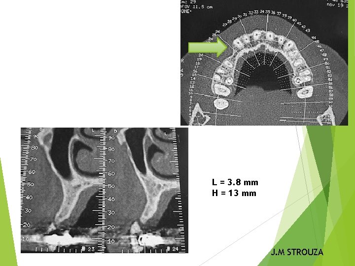 L = 3. 8 mm H = 13 mm J. M STROUZA 