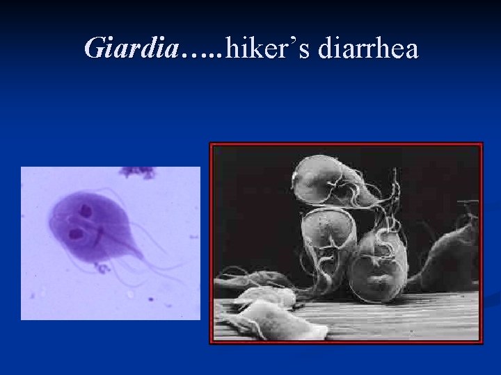 Giardia…. . hiker’s diarrhea 