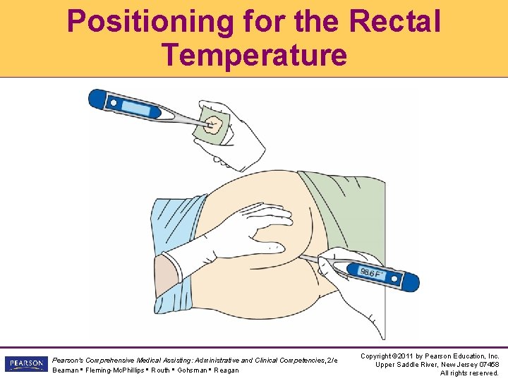 Positioning for the Rectal Temperature Pearson's Comprehensive Medical Assisting: Administrative and Clinical Competencies, 2/e