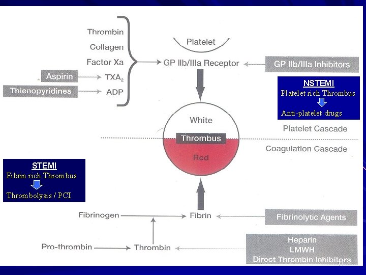 NSTEMI Platelet rich Thrombus Anti-platelet drugs STEMI Fibrin rich Thrombus Thrombolysis / PCI 11