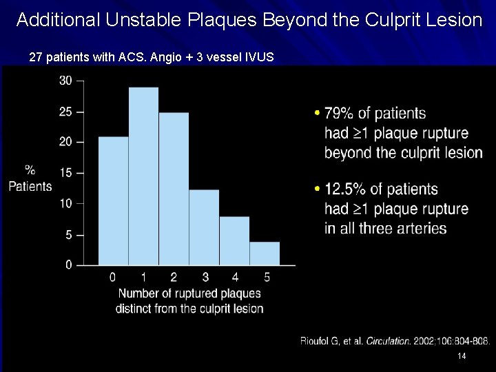 Additional Unstable Plaques Beyond the Culprit Lesion 27 patients with ACS. Angio + 3