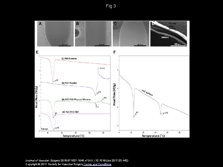 Fig 3 Journal of Vascular Surgery 2018 671537 -1545. e 7 DOI: (10. 1016/j.