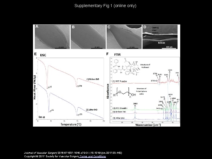 Supplementary Fig 1 (online only) Journal of Vascular Surgery 2018 671537 -1545. e 7