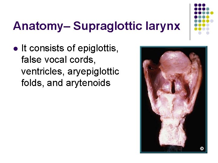 Anatomy– Supraglottic larynx l It consists of epiglottis, false vocal cords, ventricles, aryepiglottic folds,