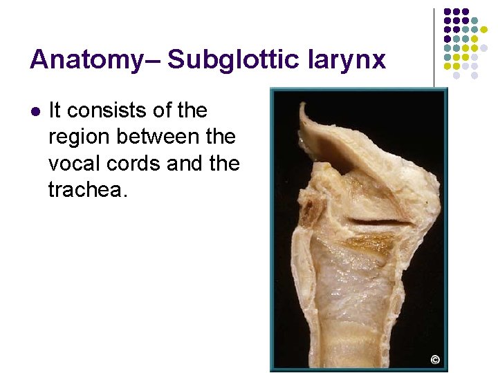 Anatomy– Subglottic larynx l It consists of the region between the vocal cords and