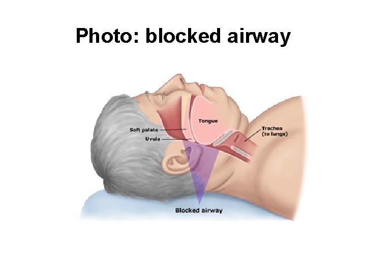 Photo: blocked airway 