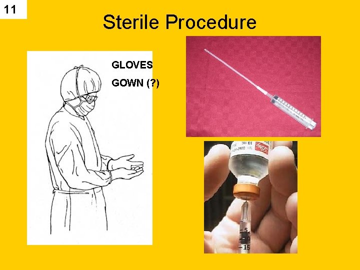 11 Sterile Procedure GLOVES GOWN (? ) 