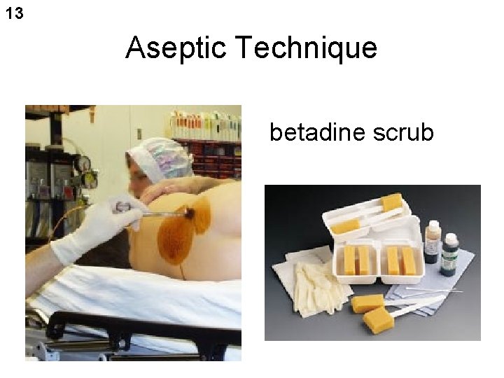 13 Aseptic Technique betadine scrub 