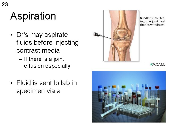 23 Aspiration • Dr’s may aspirate fluids before injecting contrast media – If there