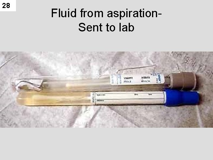 28 Fluid from aspiration. Sent to lab 