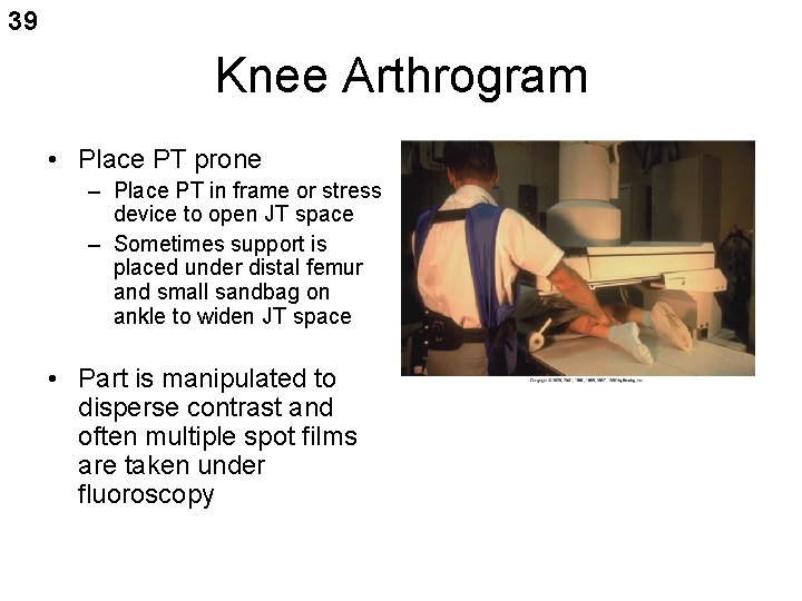 39 Knee Arthrogram • Place PT prone – Place PT in frame or stress