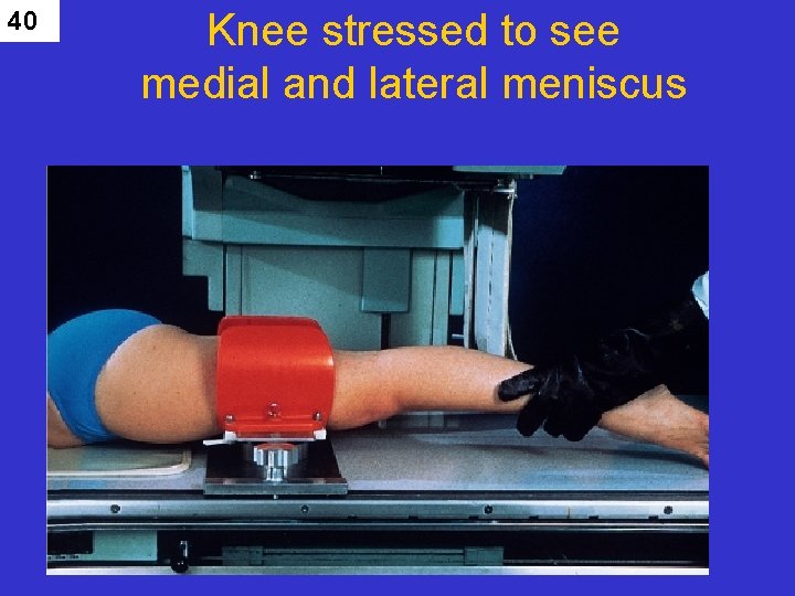 40 Knee stressed to see medial and lateral meniscus 