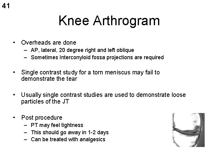 41 Knee Arthrogram • Overheads are done – AP, lateral, 20 degree right and