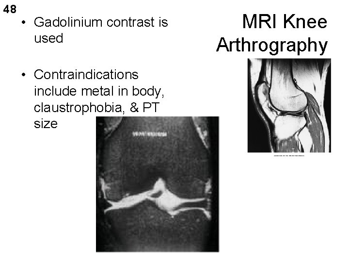 48 • Gadolinium contrast is used • Contraindications include metal in body, claustrophobia, &