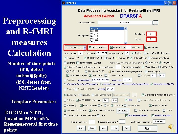 Preprocessing and R-f. MRI measures Calculation Number of time points (if 0, detect automatically)