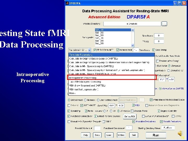 esting State f. MRI Data Processing Intraoperative Processing 76 