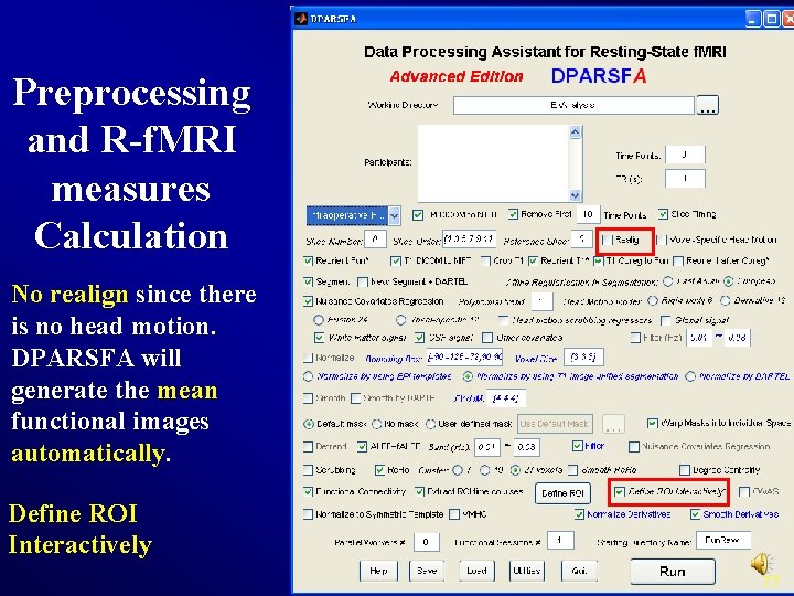 Preprocessing and R-f. MRI measures Calculation No realign since there is no head motion.