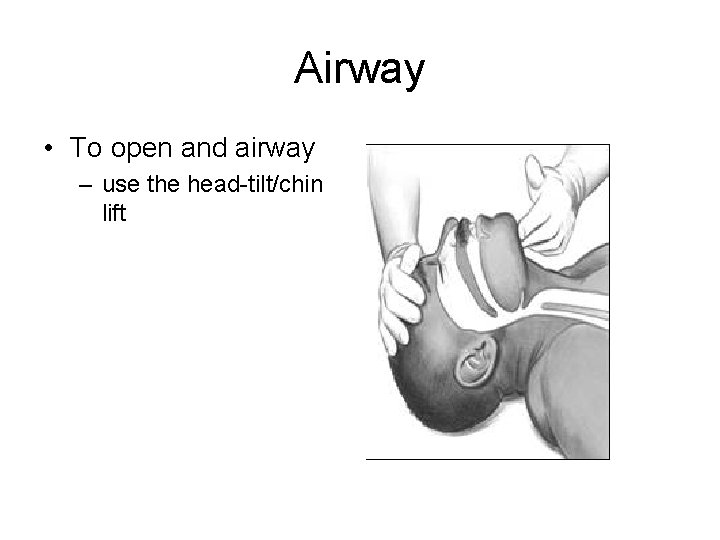 Airway • To open and airway – use the head-tilt/chin lift 