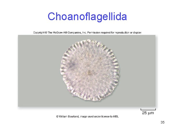 Choanoflagellida 35 