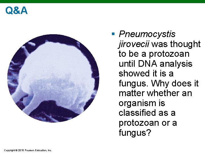 Q&A § Pneumocystis jirovecii was thought to be a protozoan until DNA analysis showed