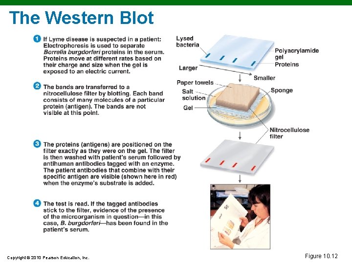 The Western Blot Copyright © 2010 Pearson Education, Inc. Figure 10. 12 