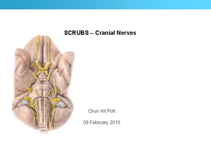 SCRUBS – Cranial Nerves Chun Kit Poh 08 February 2010 