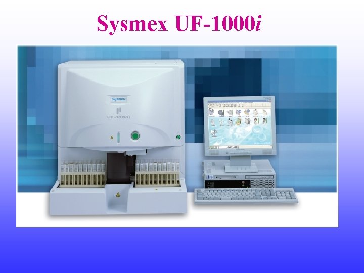 Sysmex UF-1000 i 