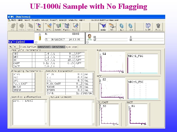 UF-1000 i Sample with No Flagging 