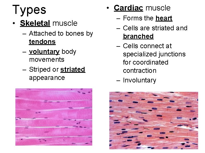 Types • Skeletal muscle – Attached to bones by tendons – voluntary body movements Types • Skeletal muscle – Attached to bones by tendons – voluntary body movements