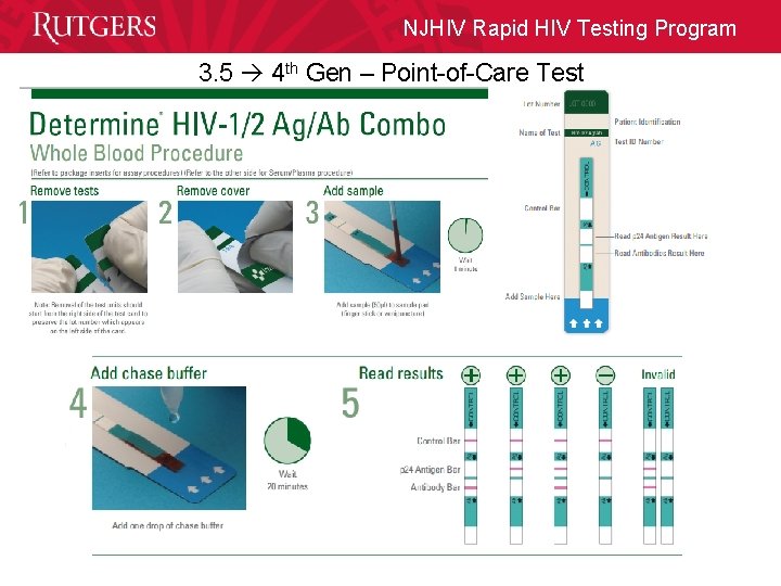 NJHIV Rapid HIV Testing Program 3. 5 4 th Gen – Point-of-Care Test 