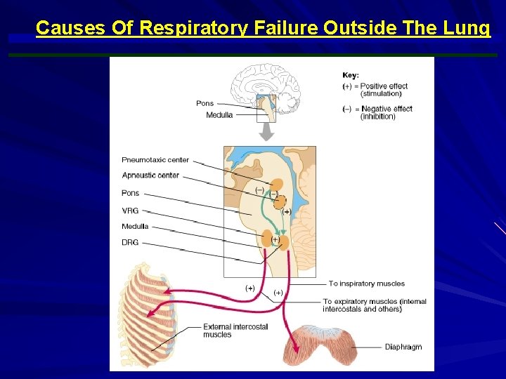Causes Of Respiratory Failure Outside The Lung 