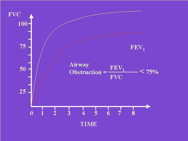 FVC 100 75 FEV 1 Airway FEV 1 Obstruction = FVC 50 < 75%