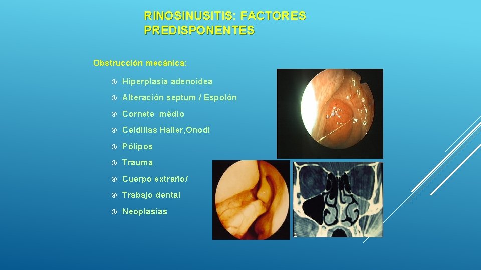RINOSINUSITIS: FACTORES PREDISPONENTES Obstrucción mecánica: Hiperplasia adenoidea Alteración septum / Espolón Cornete médio Celdillas RINOSINUSITIS: FACTORES PREDISPONENTES Obstrucción mecánica: Hiperplasia adenoidea Alteración septum / Espolón Cornete médio Celdillas